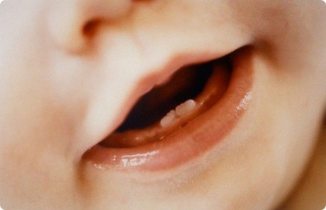 Выявлен ген, отвечающий за рост зубов у малышей