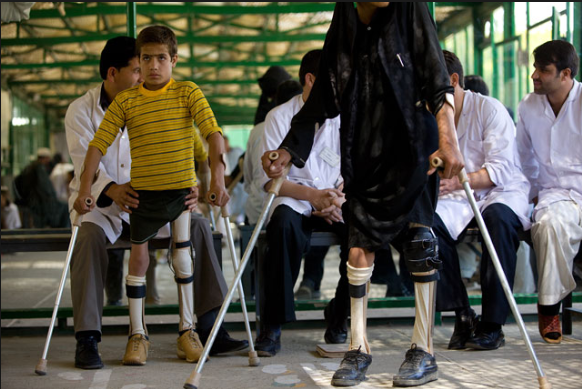 Інвалідність після перенесеного поліомієліту