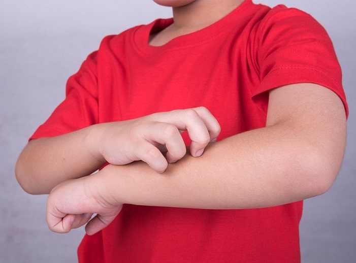 Аллергия на коже рук у детей